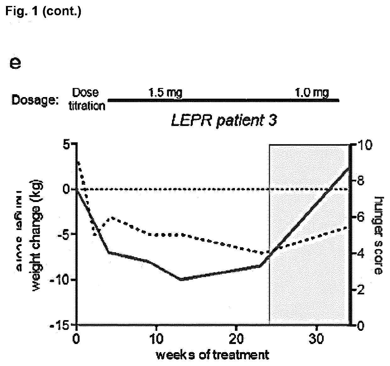 MC4R Agonist Efficacy in Subjects with MC4R Deficiencies and Impaired NFAT Signaling