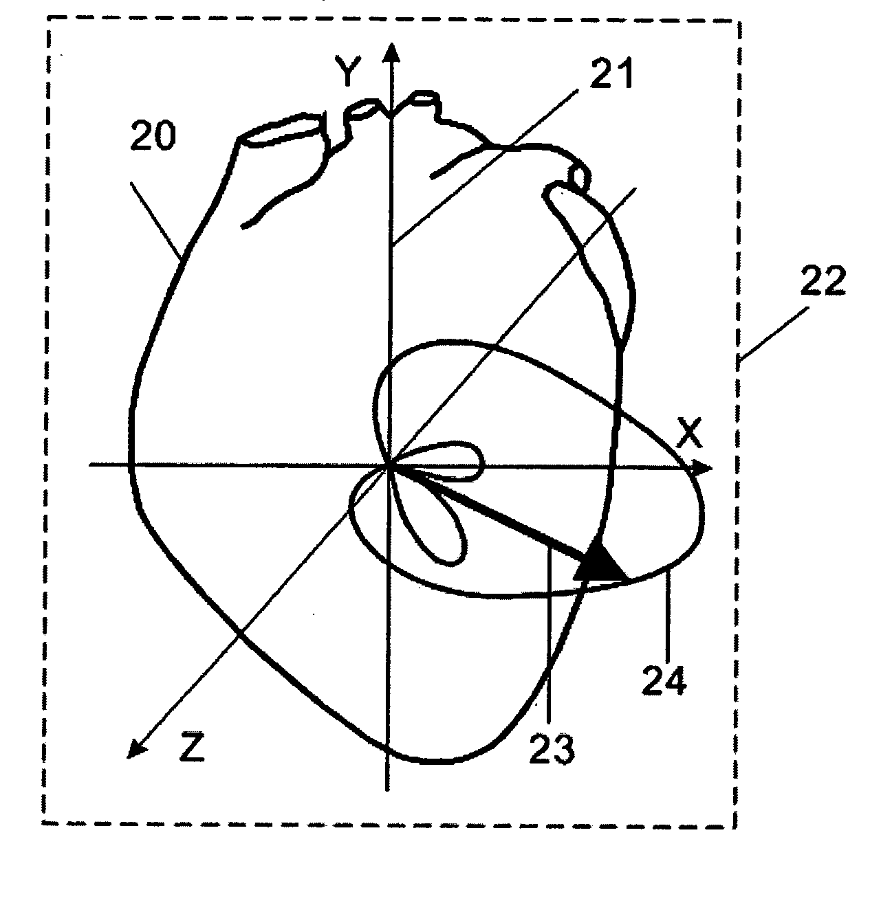 Device and procedure for visual three-dimensional presentation of ECG data