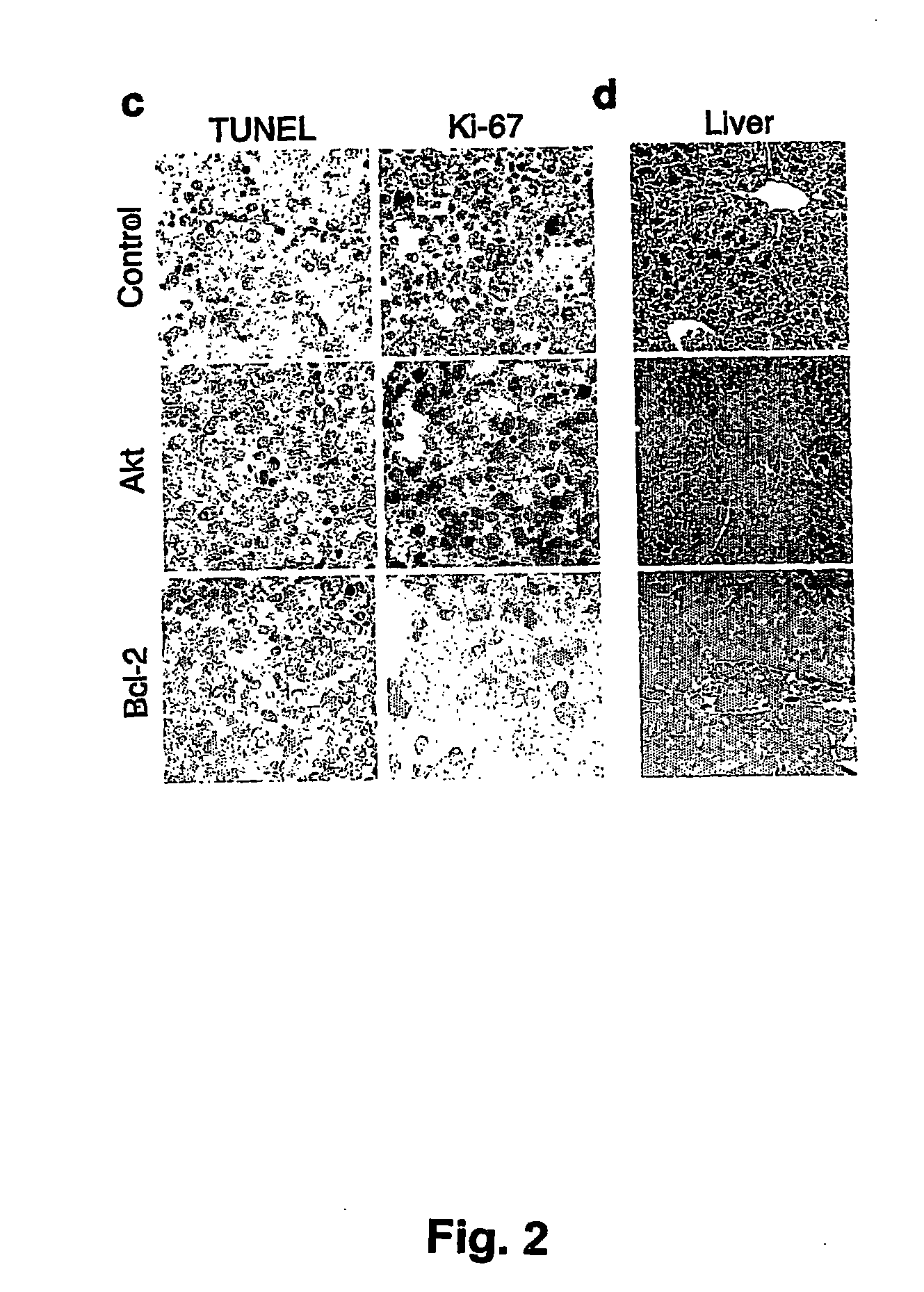 Model for studying the role of genes in tumor resistance to chemotherapy