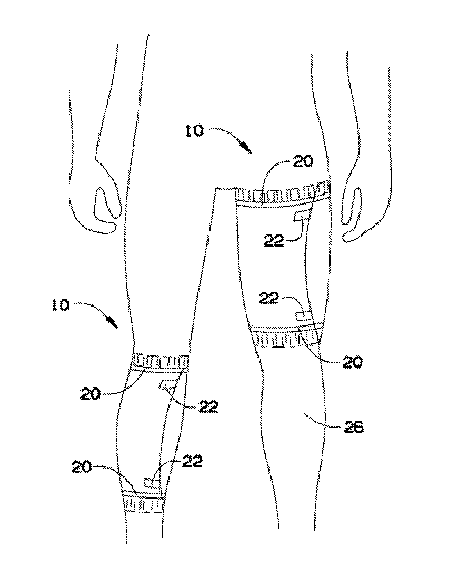 Enclosing bandage for providing comfortable wound care and limiting fluid leakage