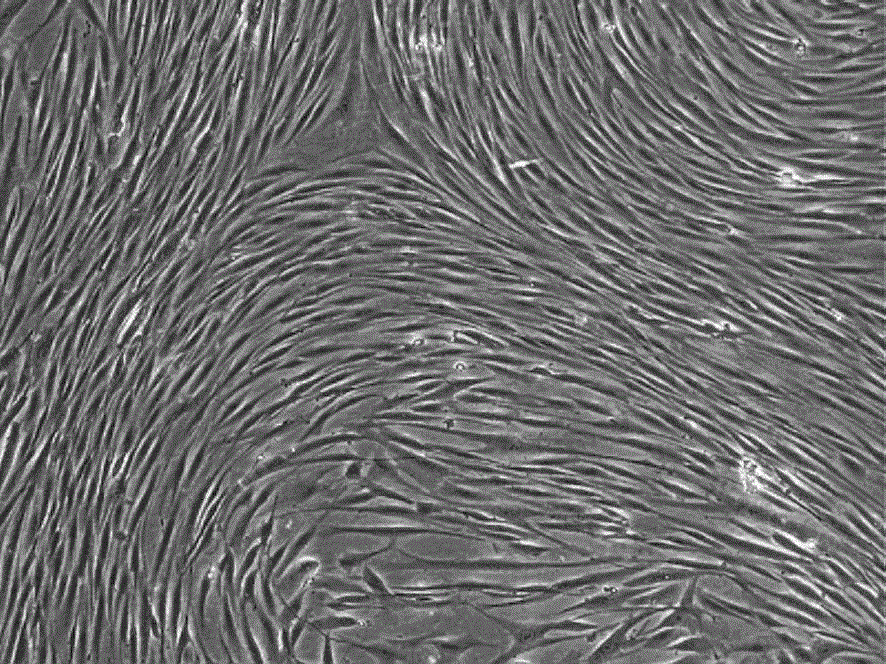 Inducer and induced differentiation complete medium for inducing mesenchymal stem cells into nerve cells