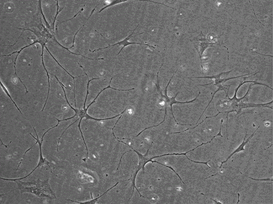 Inducer and induced differentiation complete medium for inducing mesenchymal stem cells into nerve cells