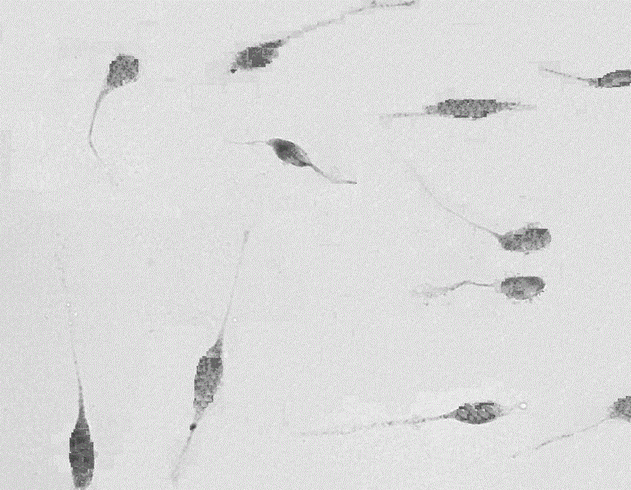 Inducer and induced differentiation complete medium for inducing mesenchymal stem cells into nerve cells