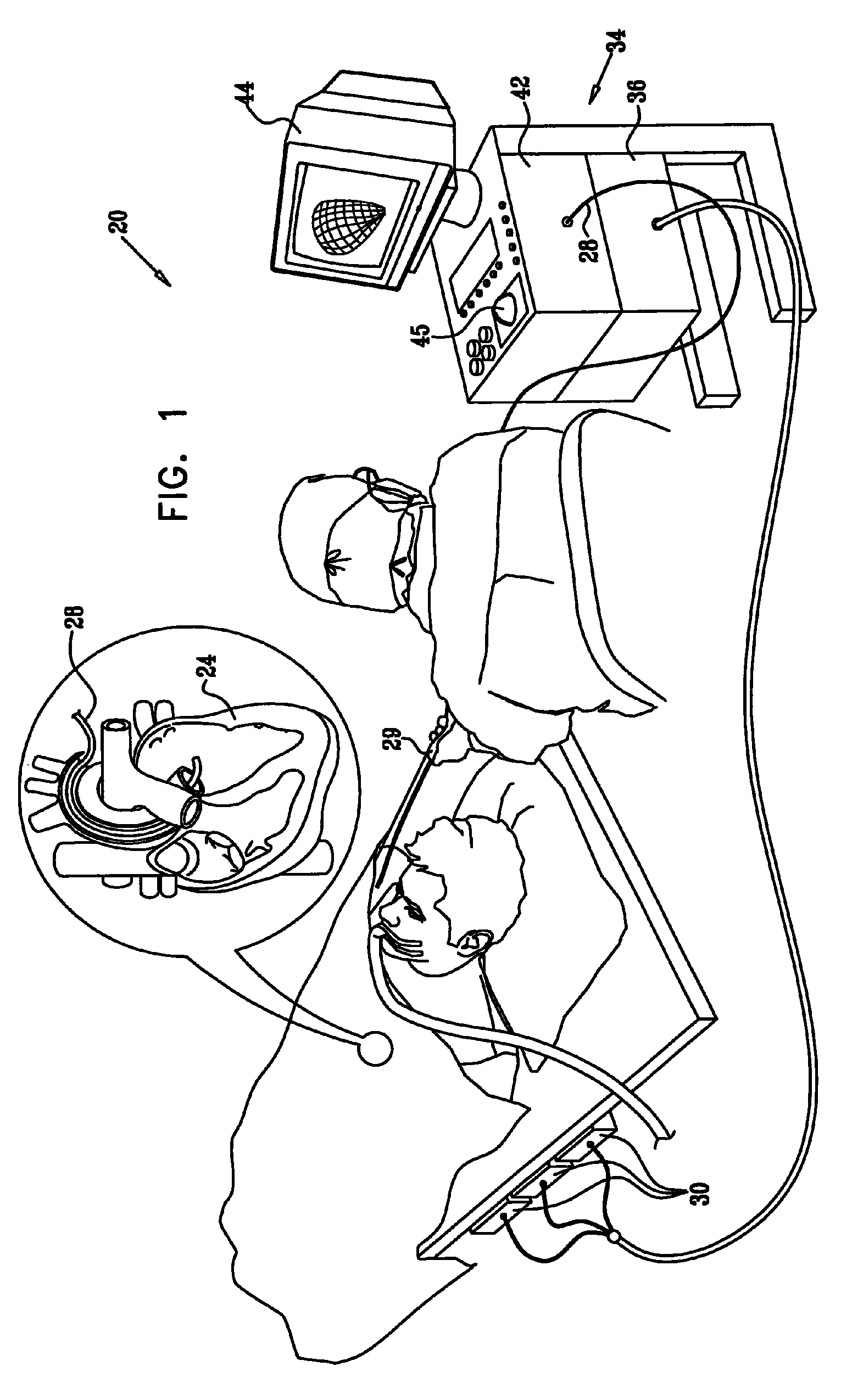 Synchronization of ultrasound imaging data with electrical mapping