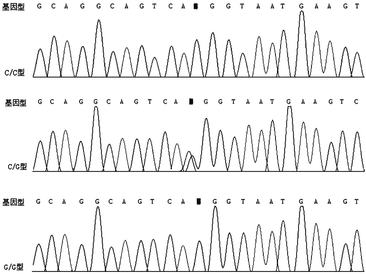 Biomarker for early diagnosis of ankylosing spondylitis and application thereof in kit