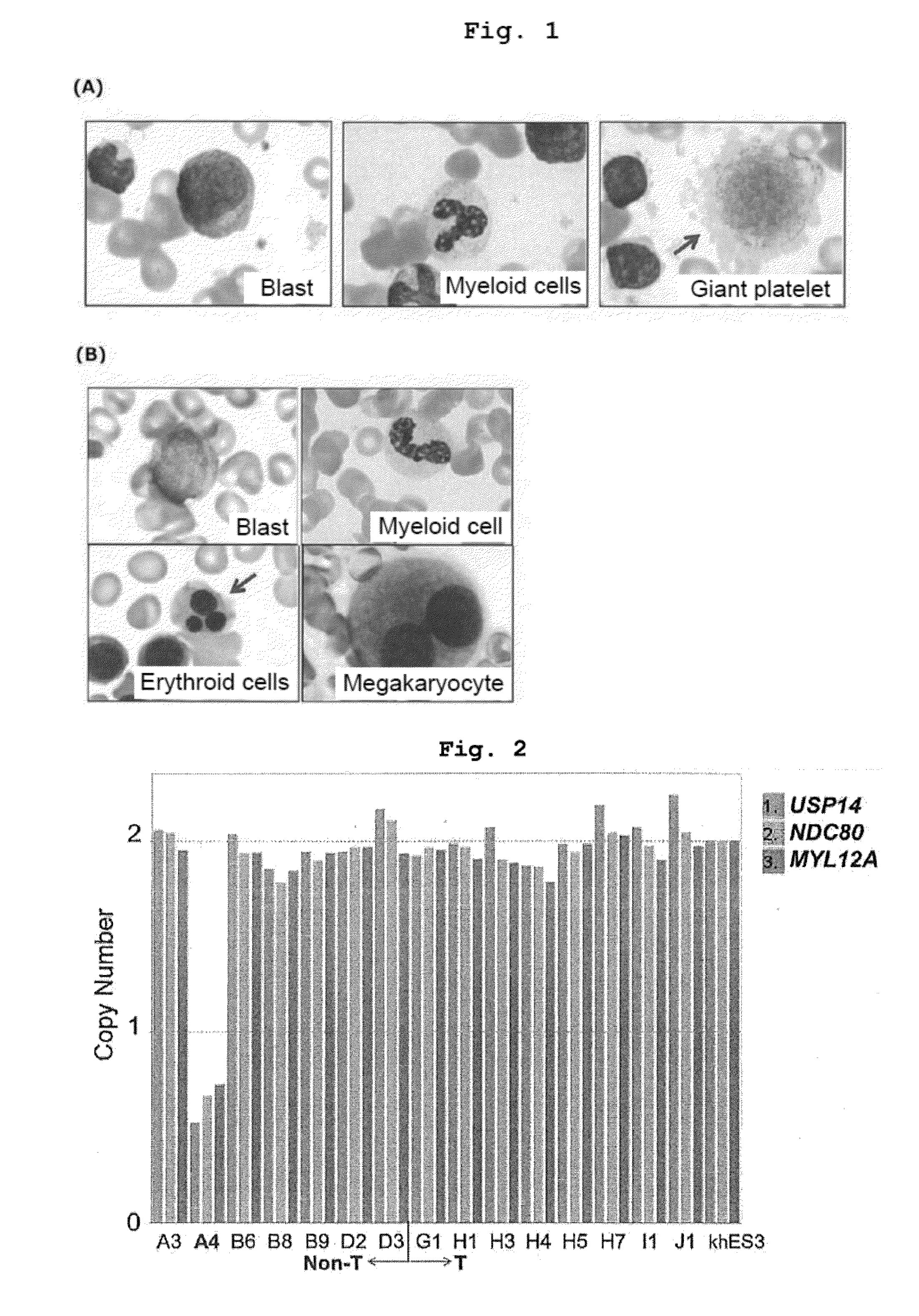 Method for screening drugs for treating/preventing myelodysplastic syndrome, etc.