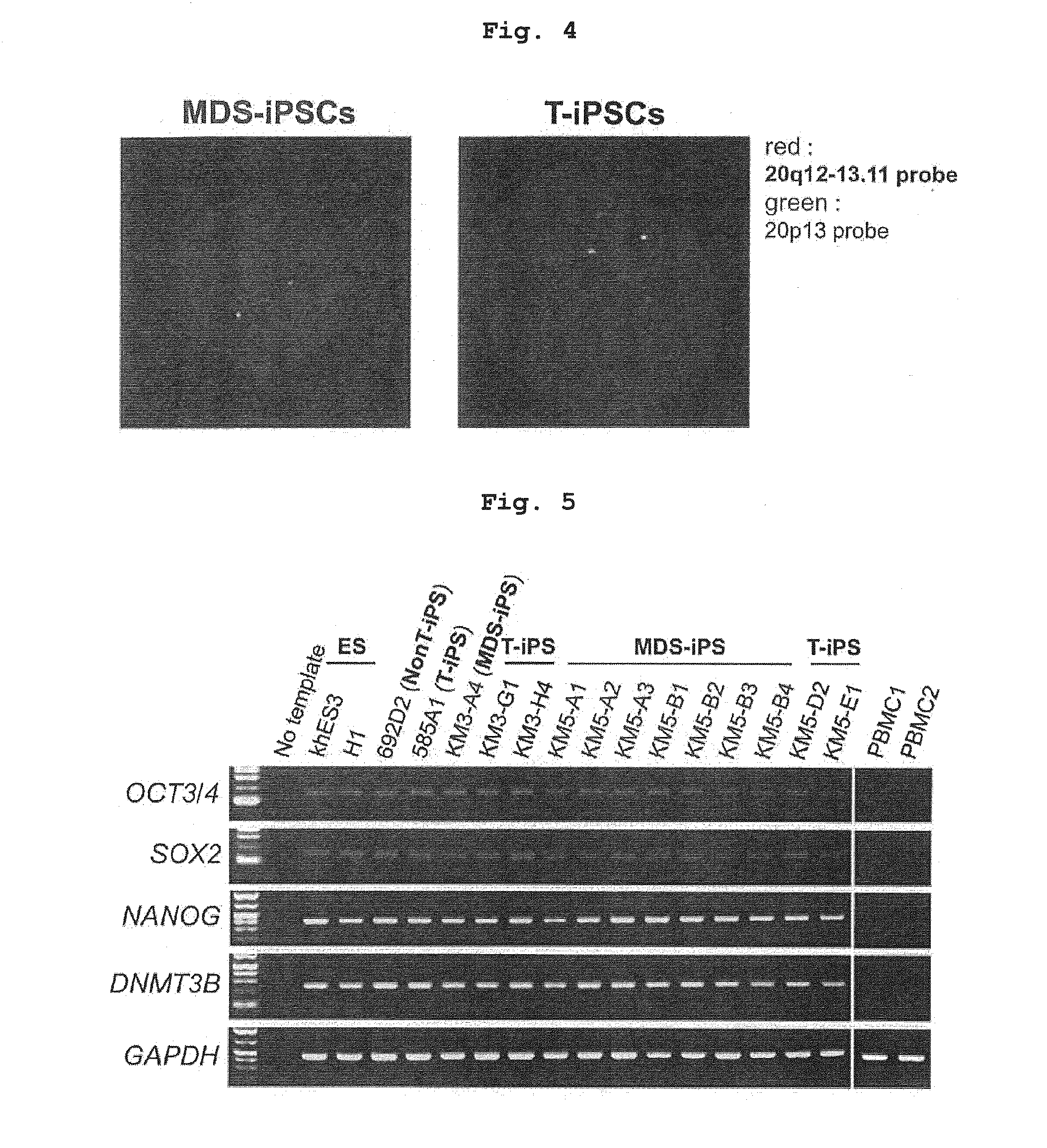 Method for screening drugs for treating/preventing myelodysplastic syndrome, etc.