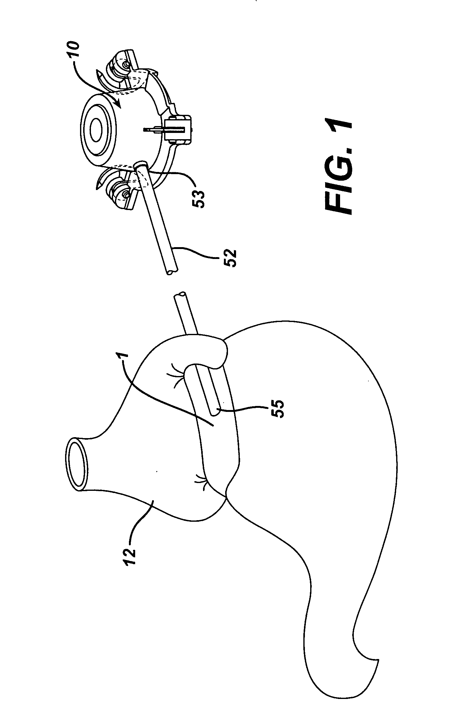 Surgically implantable injection port having an absorbable fastener