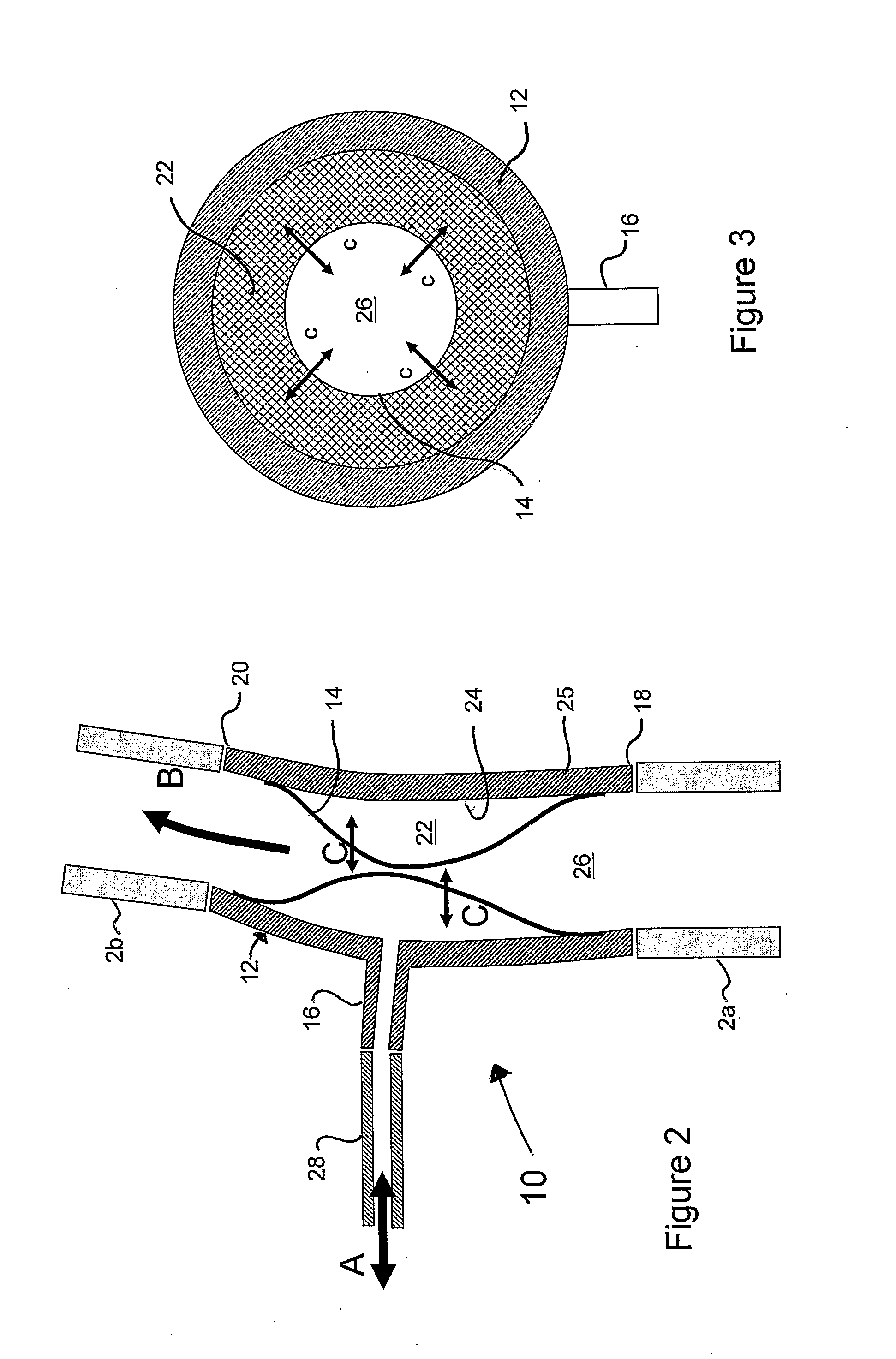 Pulsatile blood pump