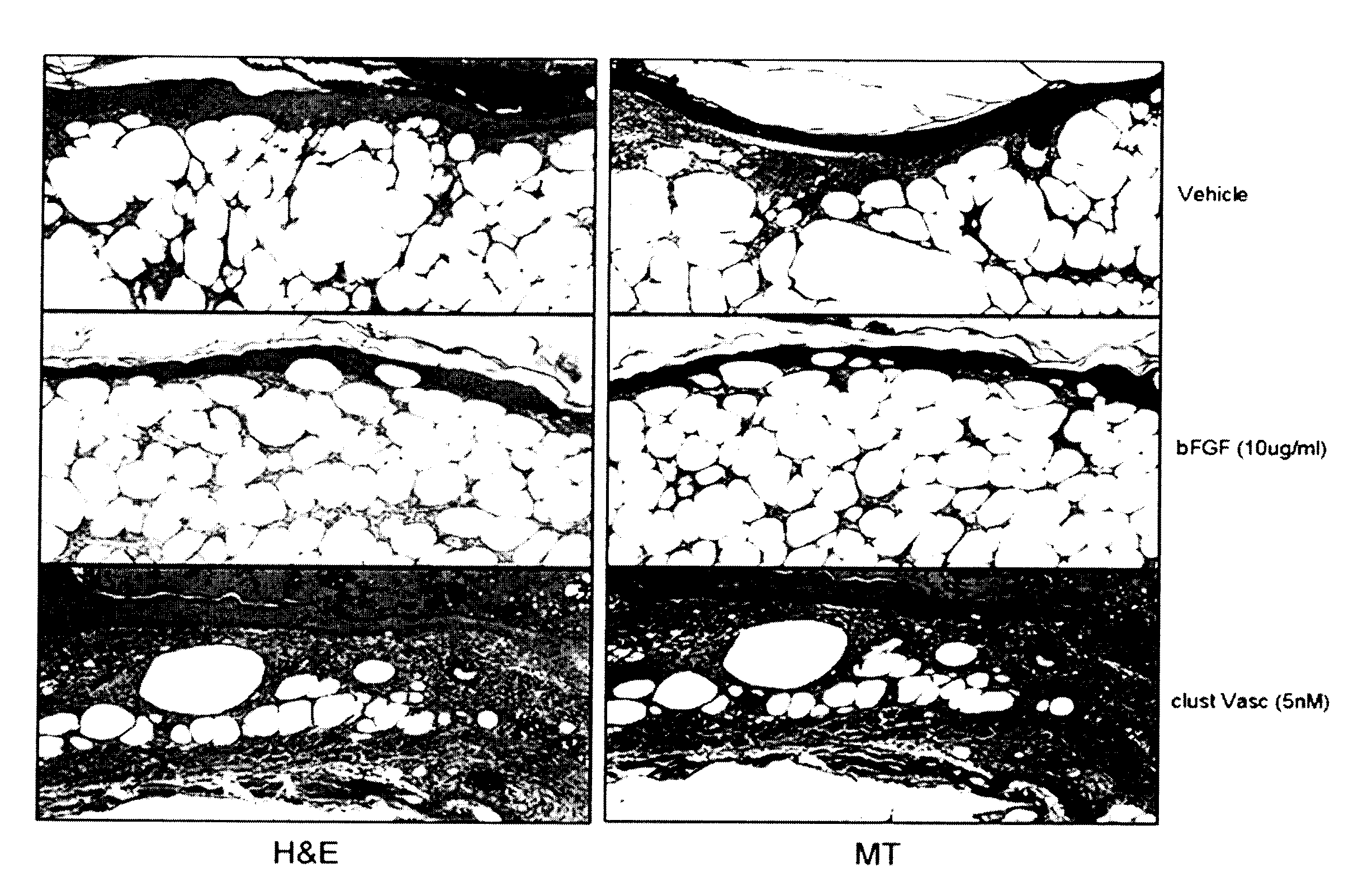 Multimeric tie 2 agonists and uses thereof in stimulating angiogenesis