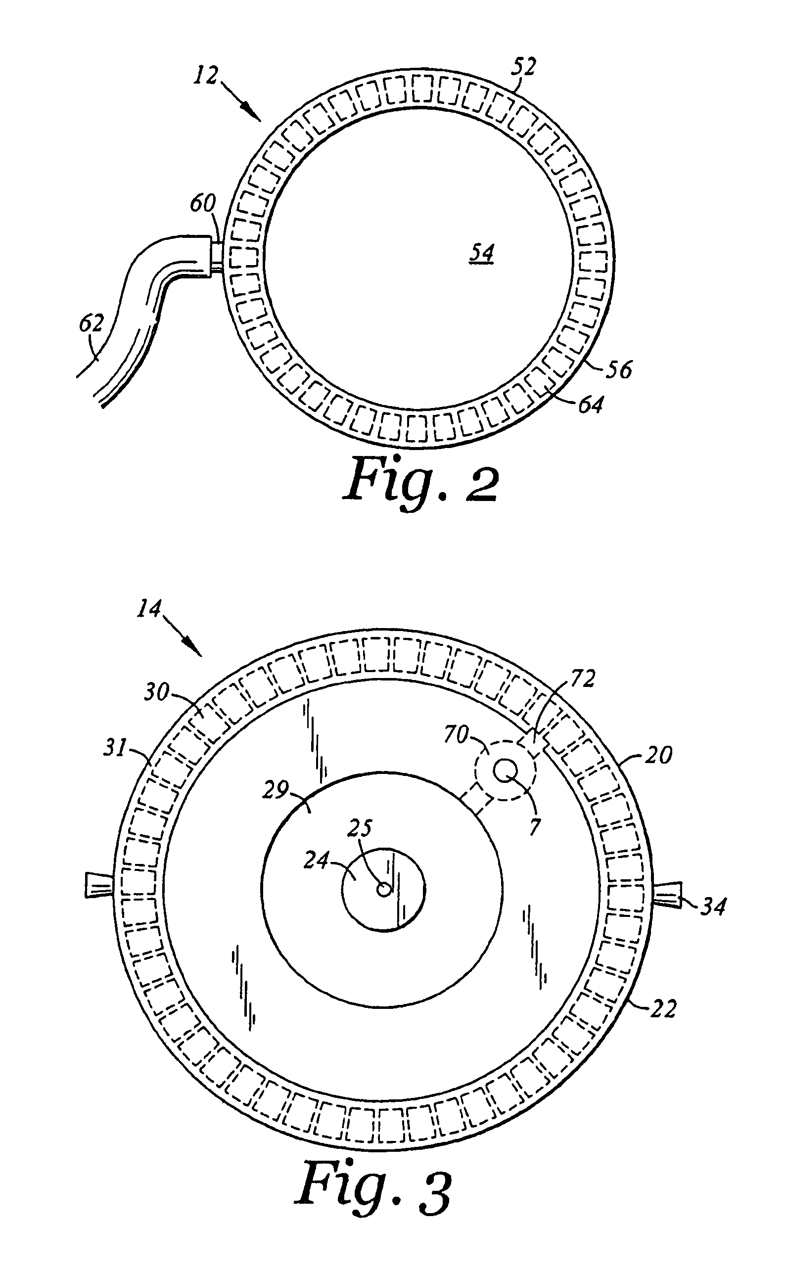 Implantable central venous injection port and external needle guide