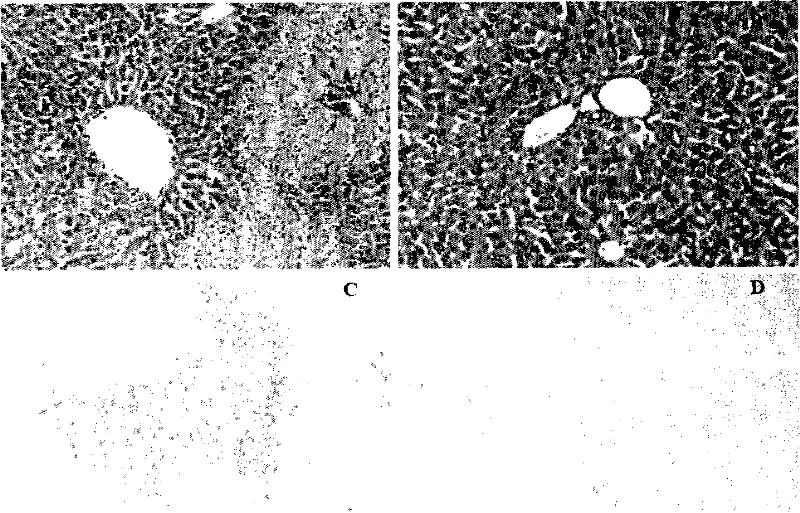 A drug target related to liver injury and its application