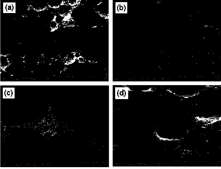 Calcium phosphate/collagen composite biologic ceramic material and preparation method thereof