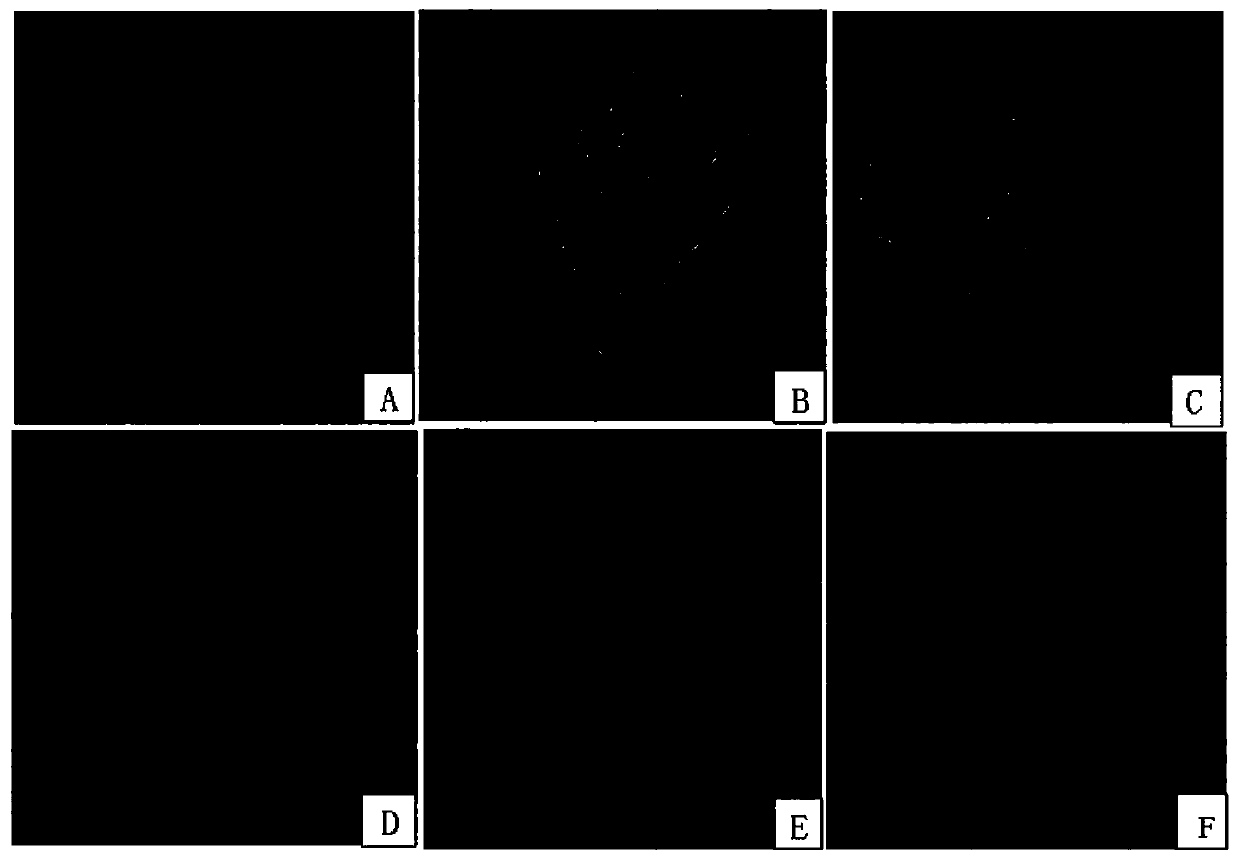 Preparation method and application of quercetin lipidosome