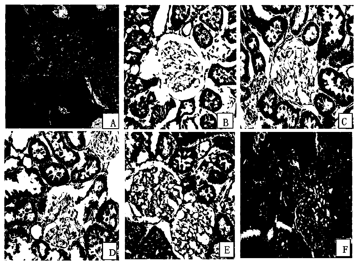 Preparation method and application of quercetin lipidosome