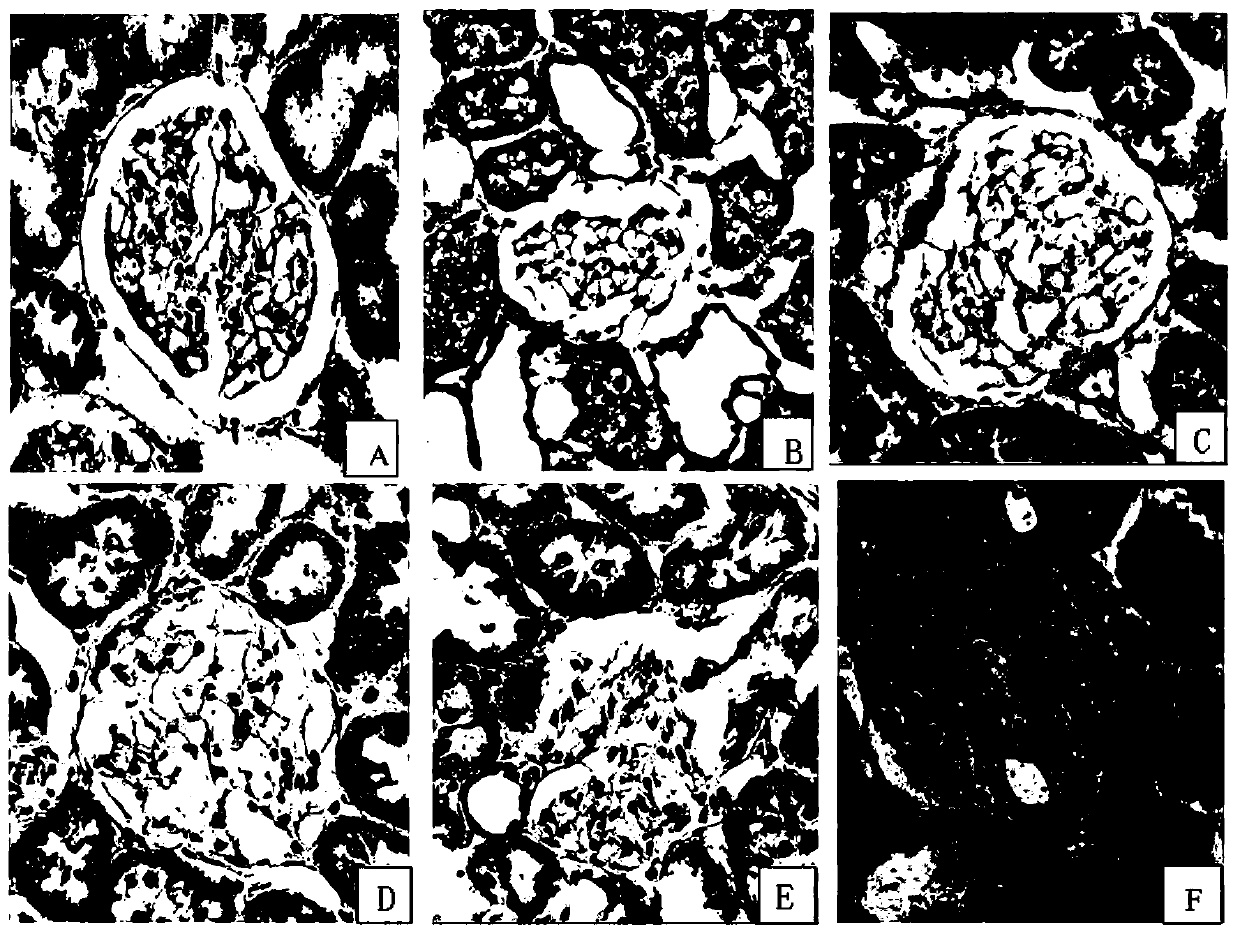 Preparation method and application of quercetin lipidosome