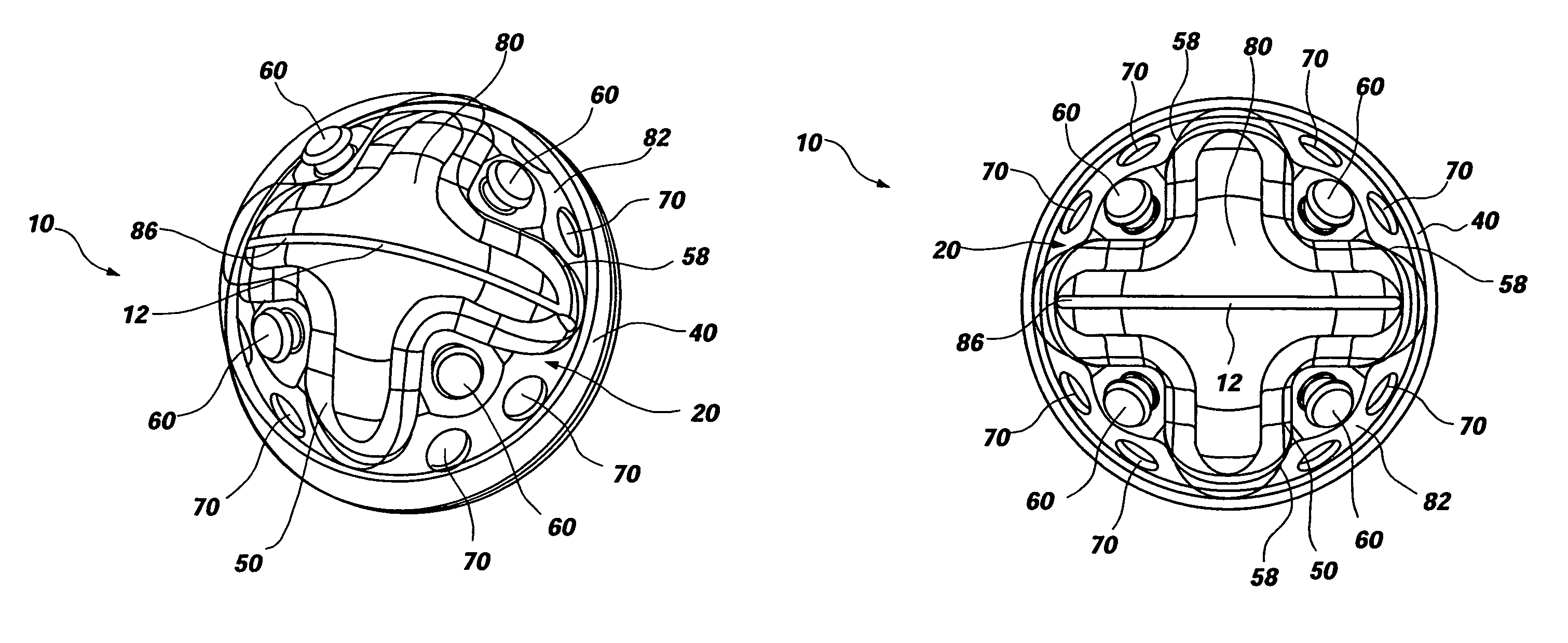 Polymeric acetabular cup