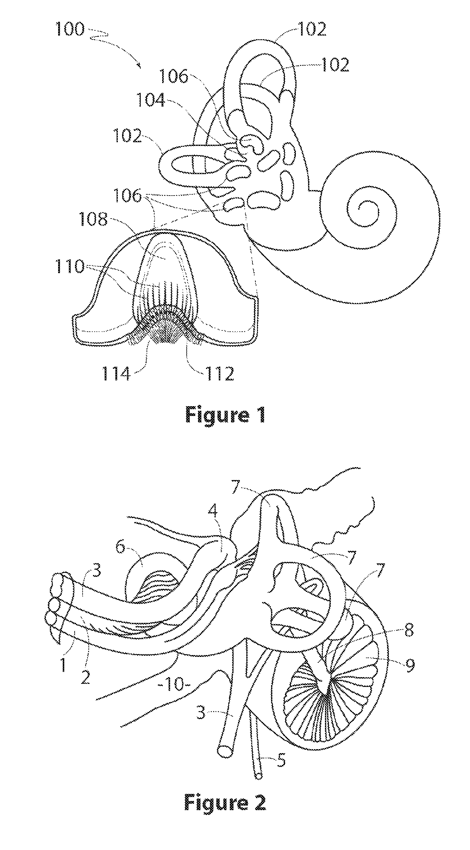 Vestibular stimulation device