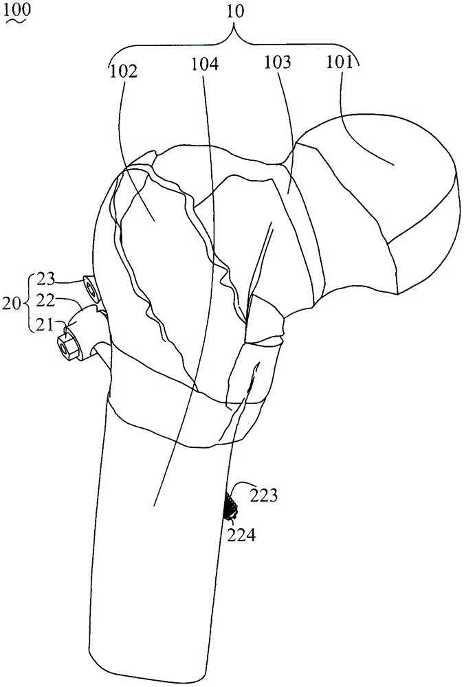 Femoral neck fixing mechanism and femoral neck fracture fixing structure thereof