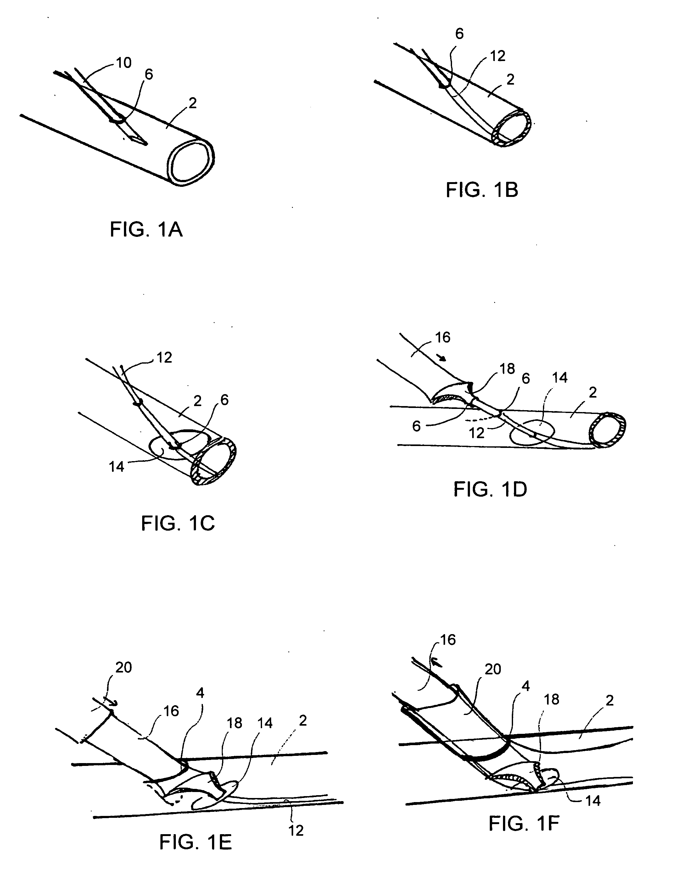 Devices and methods for the controlled formation and closure of vascular openings