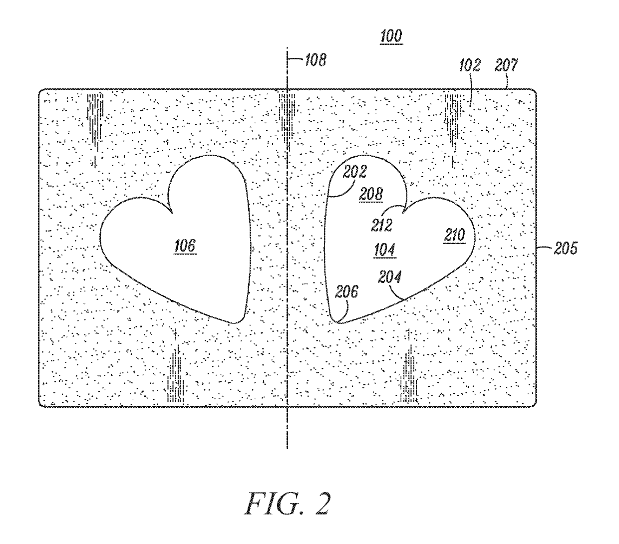 Surgical recovery pillow