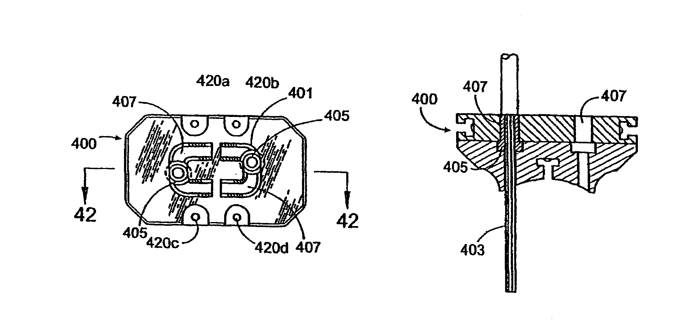 Bone removal device