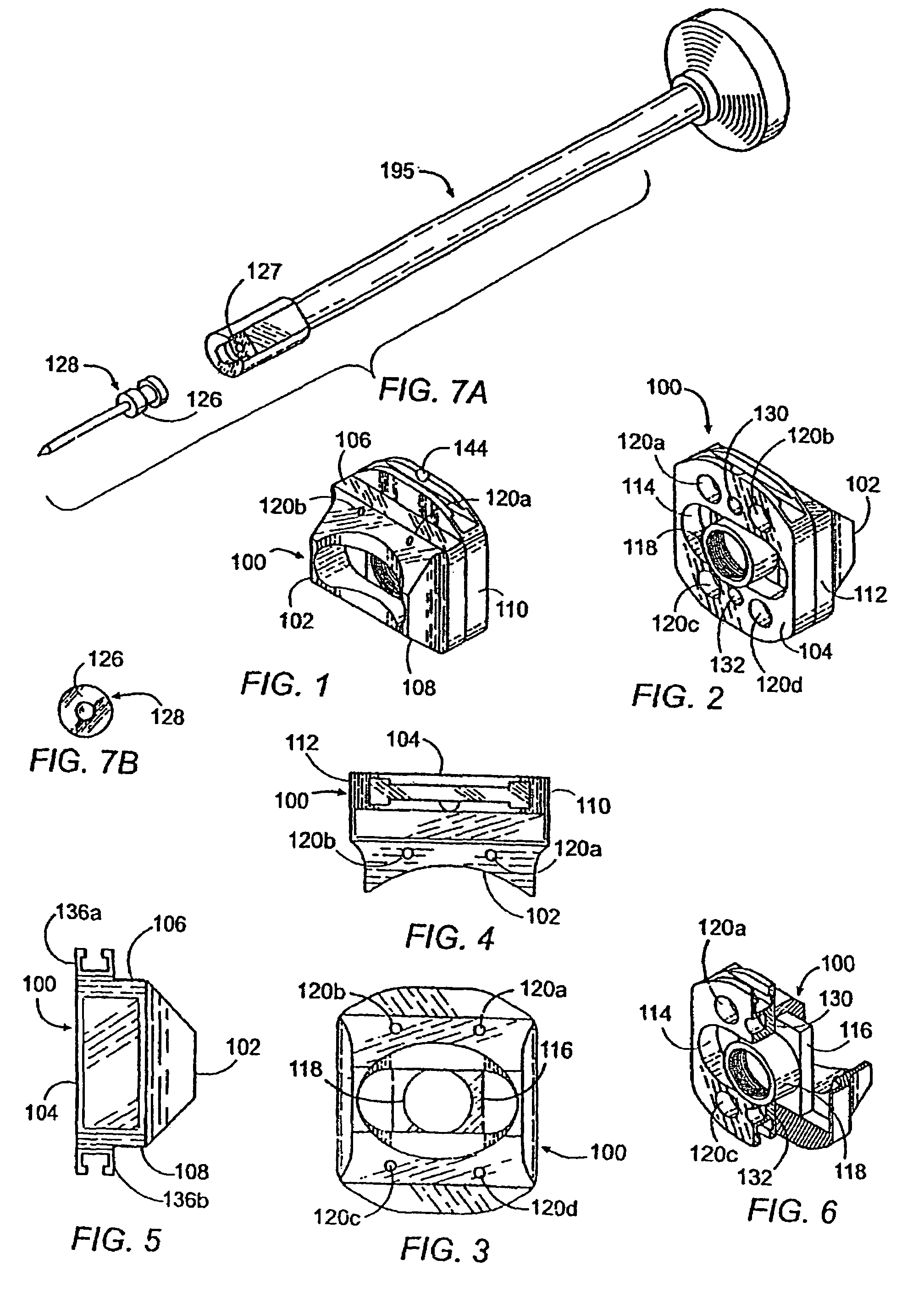 Bone removal device