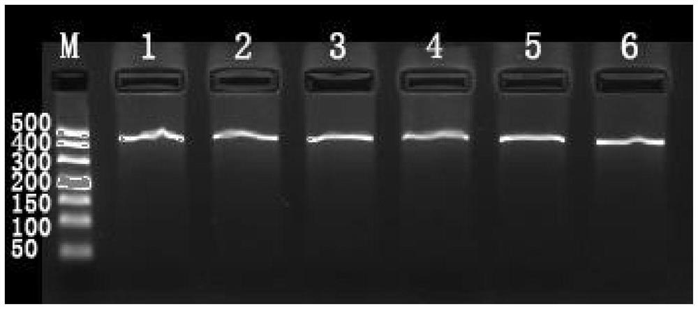 hla-related snp markers and its detection primer pair and determination method