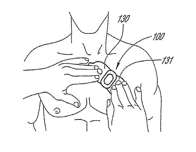 Physiological monitoring device