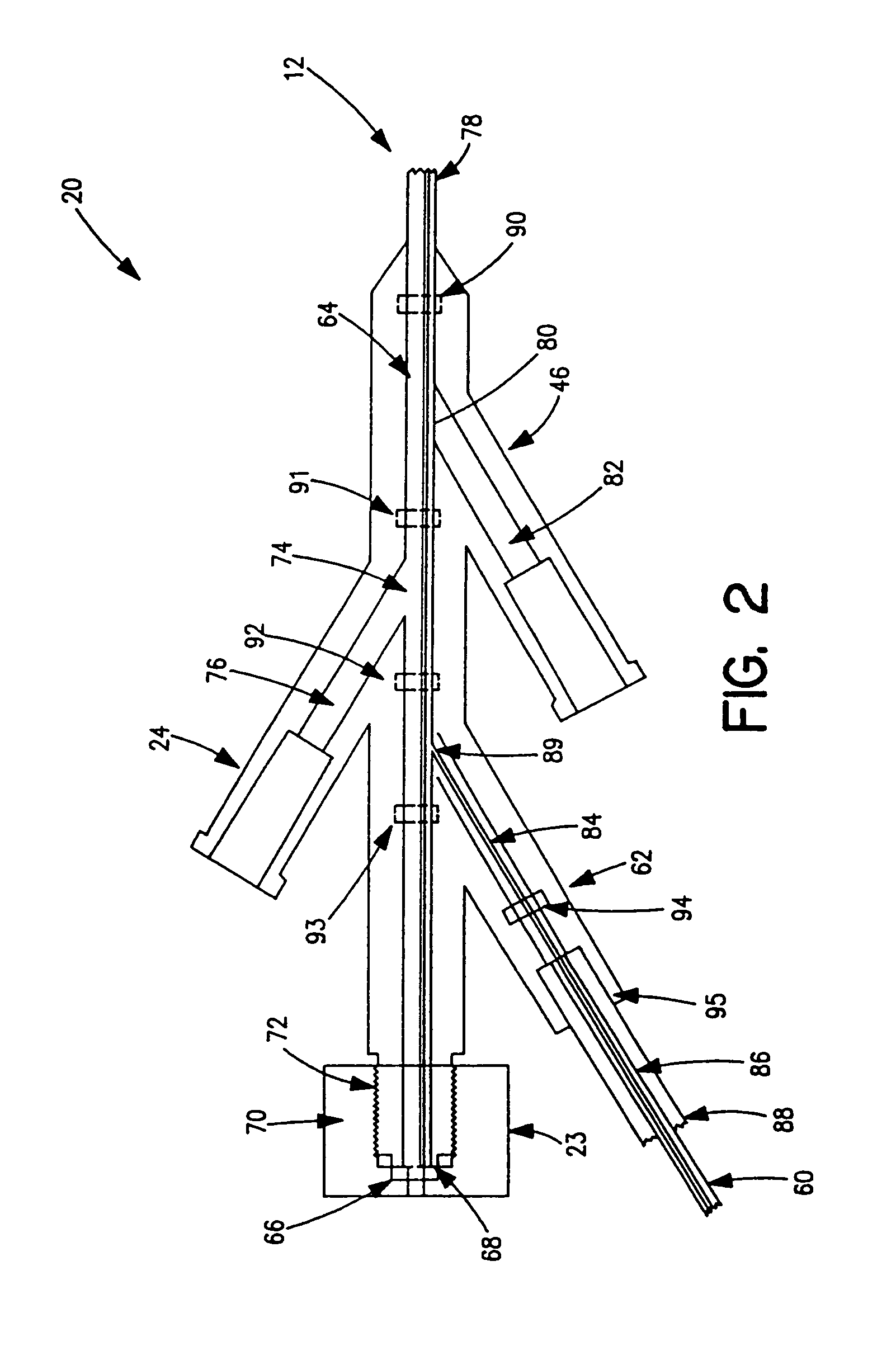 Thrombectomy and tissue removal method