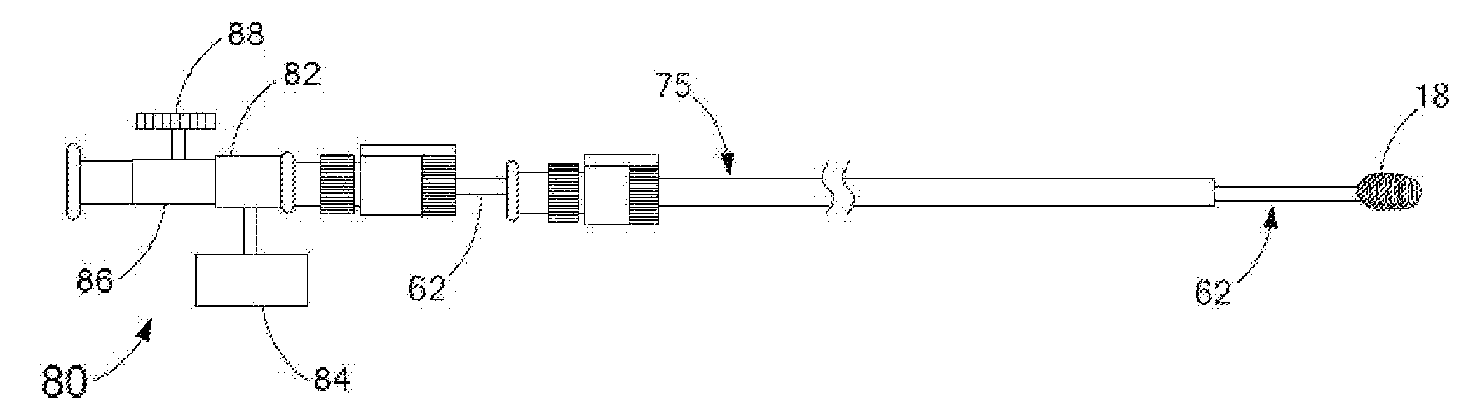 Occlusion device