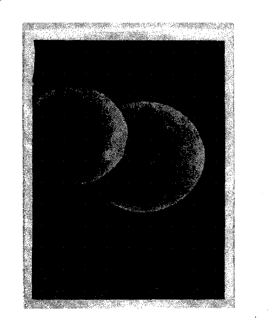 Minocycline hydrochloride microballoons and preparation method and application in pharmacy thereof