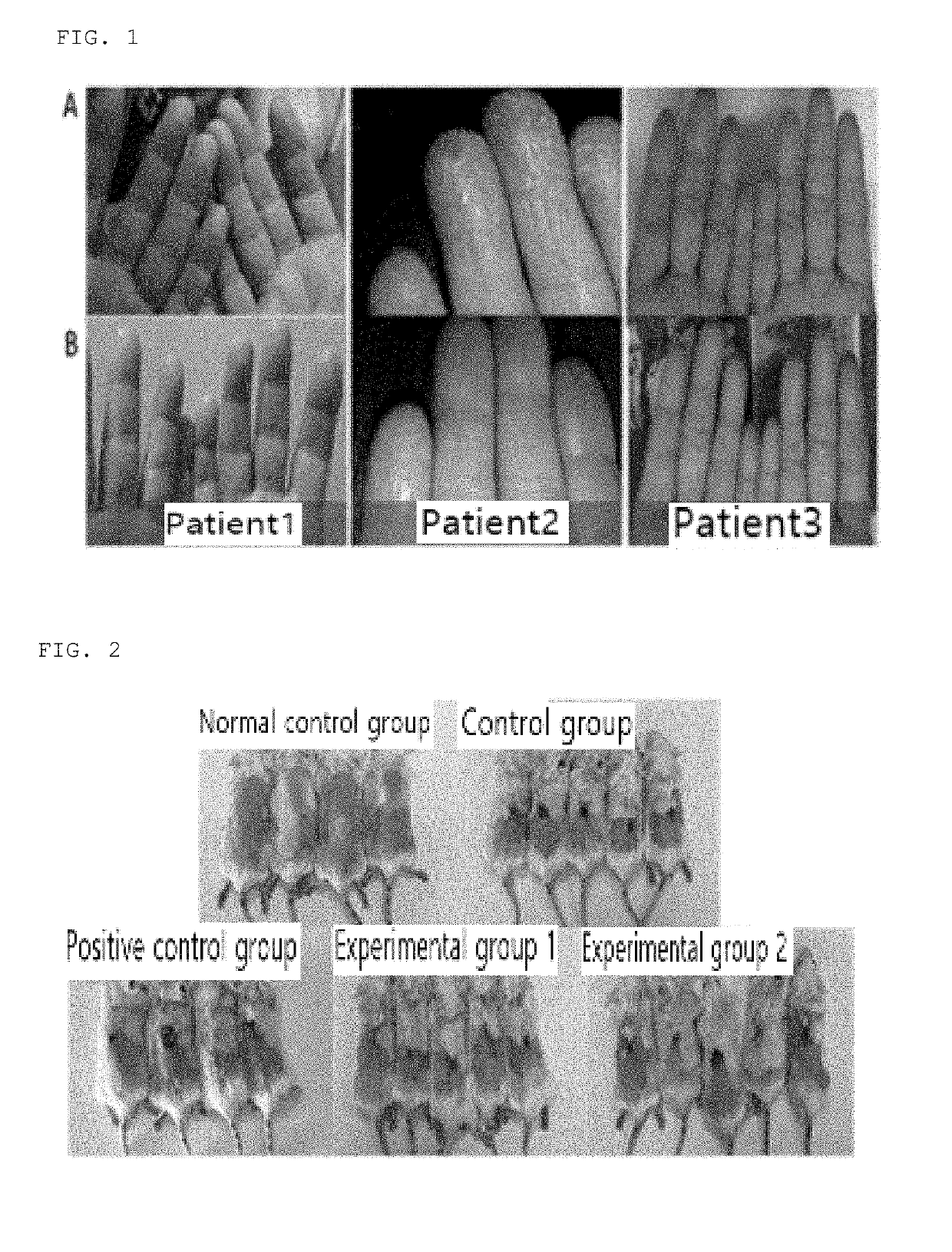 Pharmaceutical composition comprising purple corn extract for prevention or treatment of skin disease