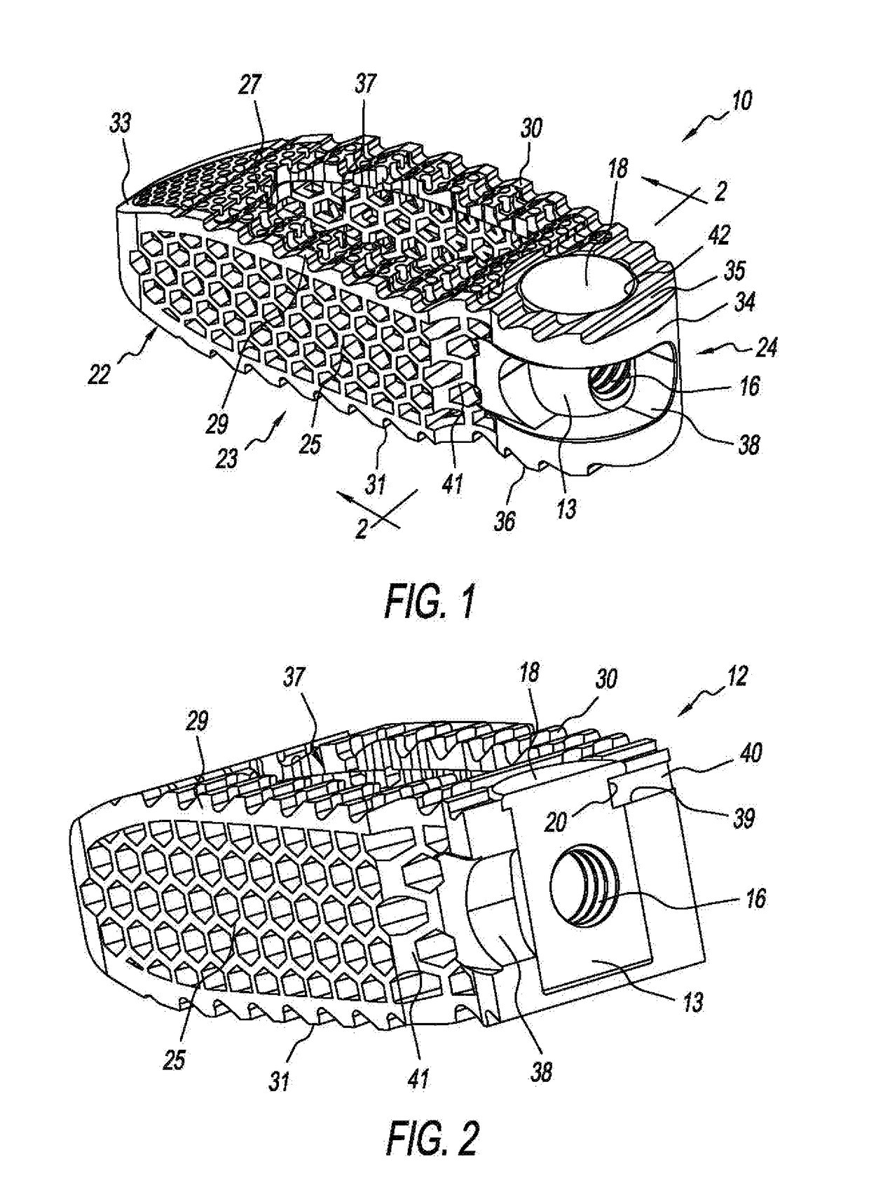 Steerable TLIF Spine Implants