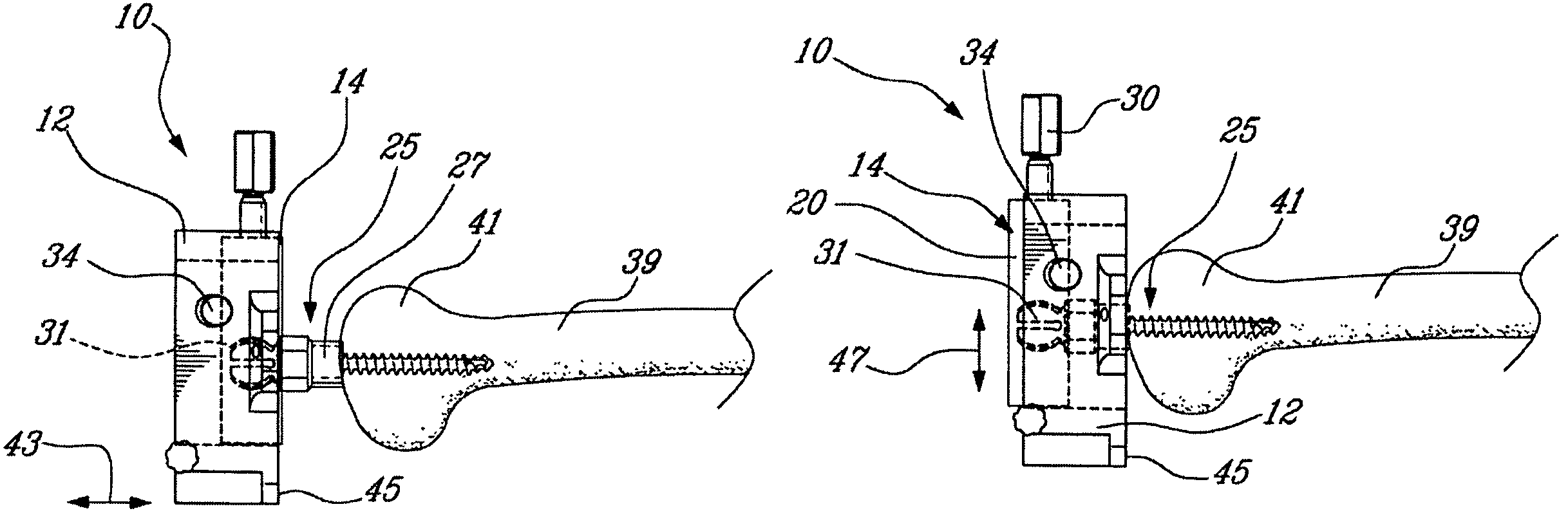 Surgical universal positioning block and tool guide