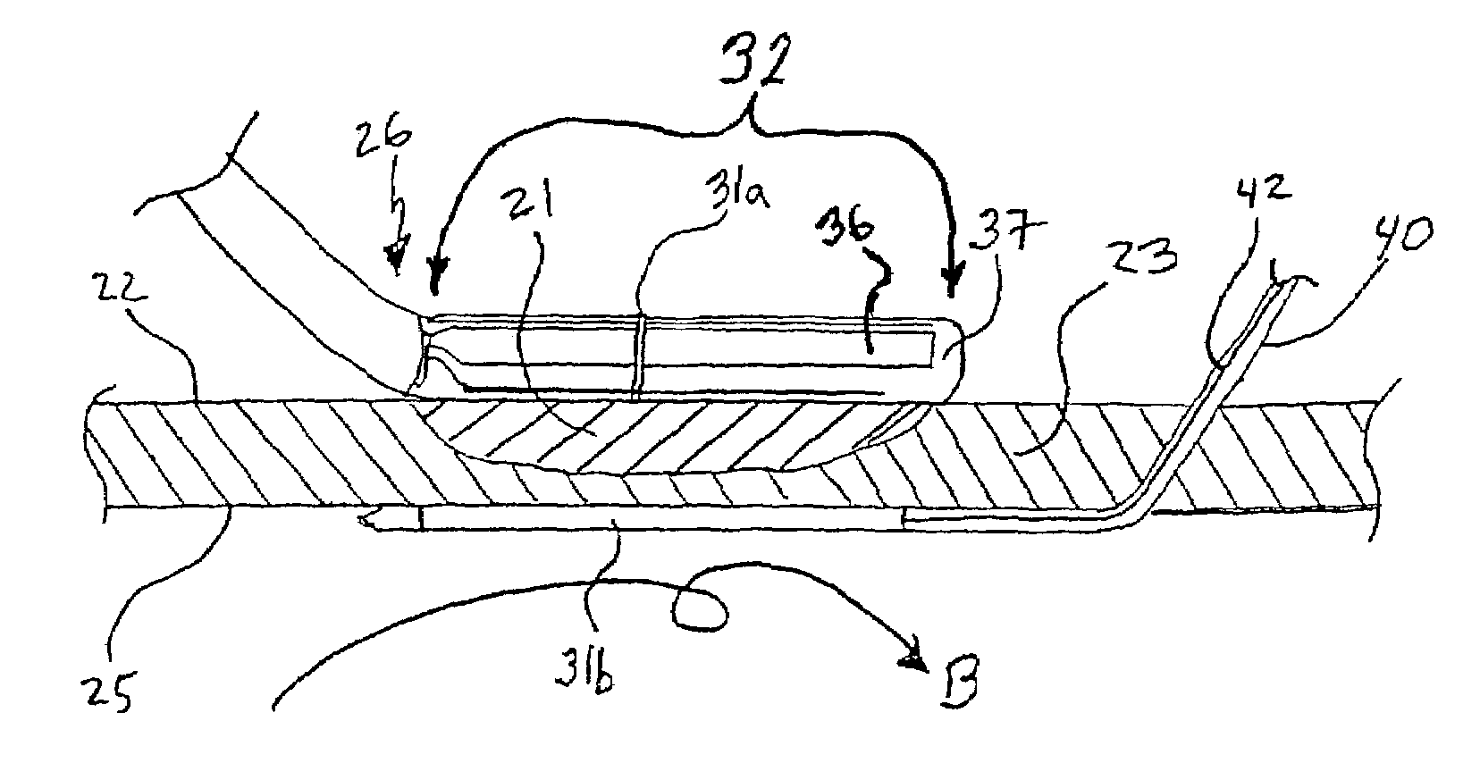 Apparatus and method for assessing transmurality of a tissue ablation