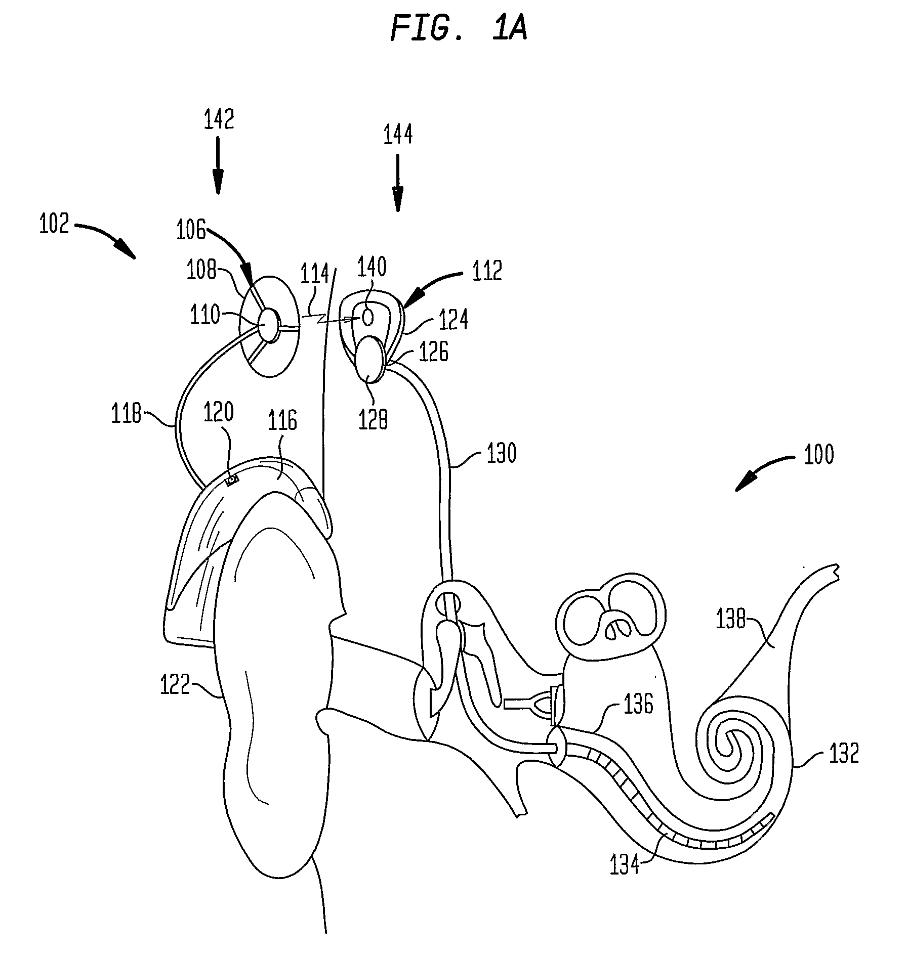 Transformable speech processor module for a hearing prosthesis