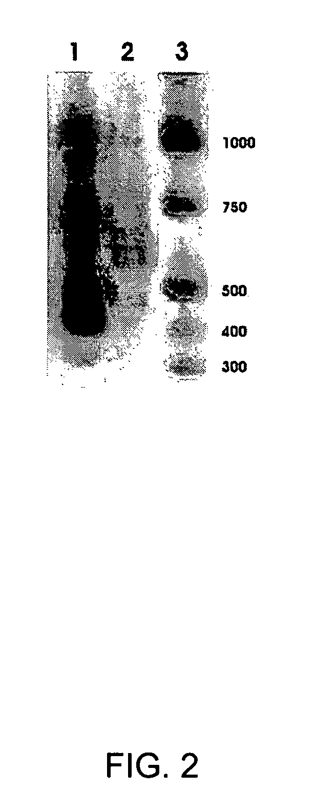 Methods to increase reverse cholesterol transport in the retinal pigment epithelium (RPE) and Bruch's membrane (BM)