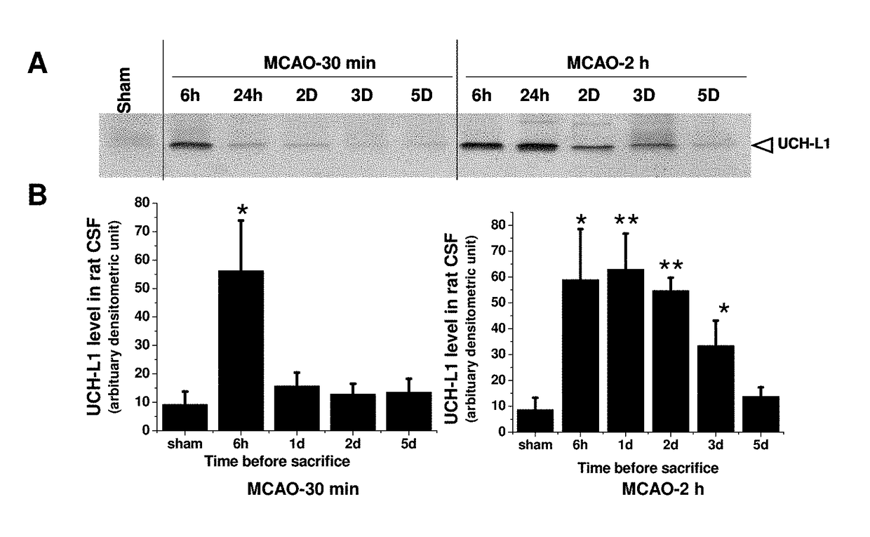 Biomarker detection process and assay of neurological condition