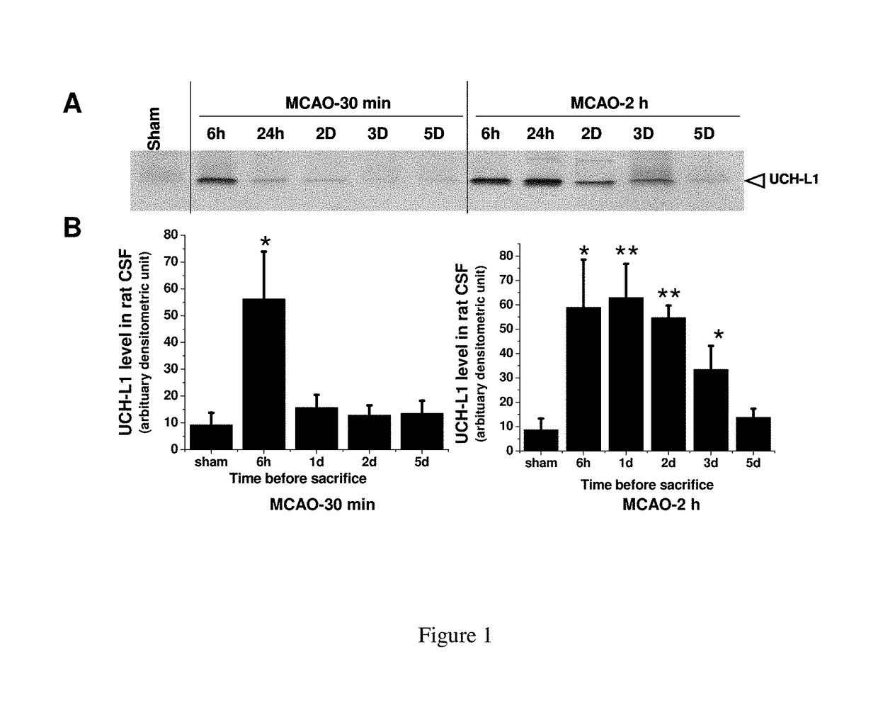 Biomarker detection process and assay of neurological condition