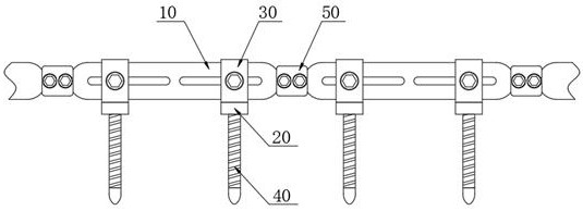 Combined type clamping mechanism for internal fixation of spine