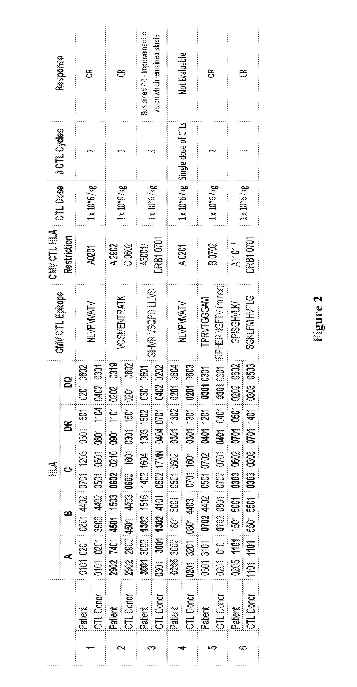 Methods of Treating CMV Retinitis by T Cell Therapy