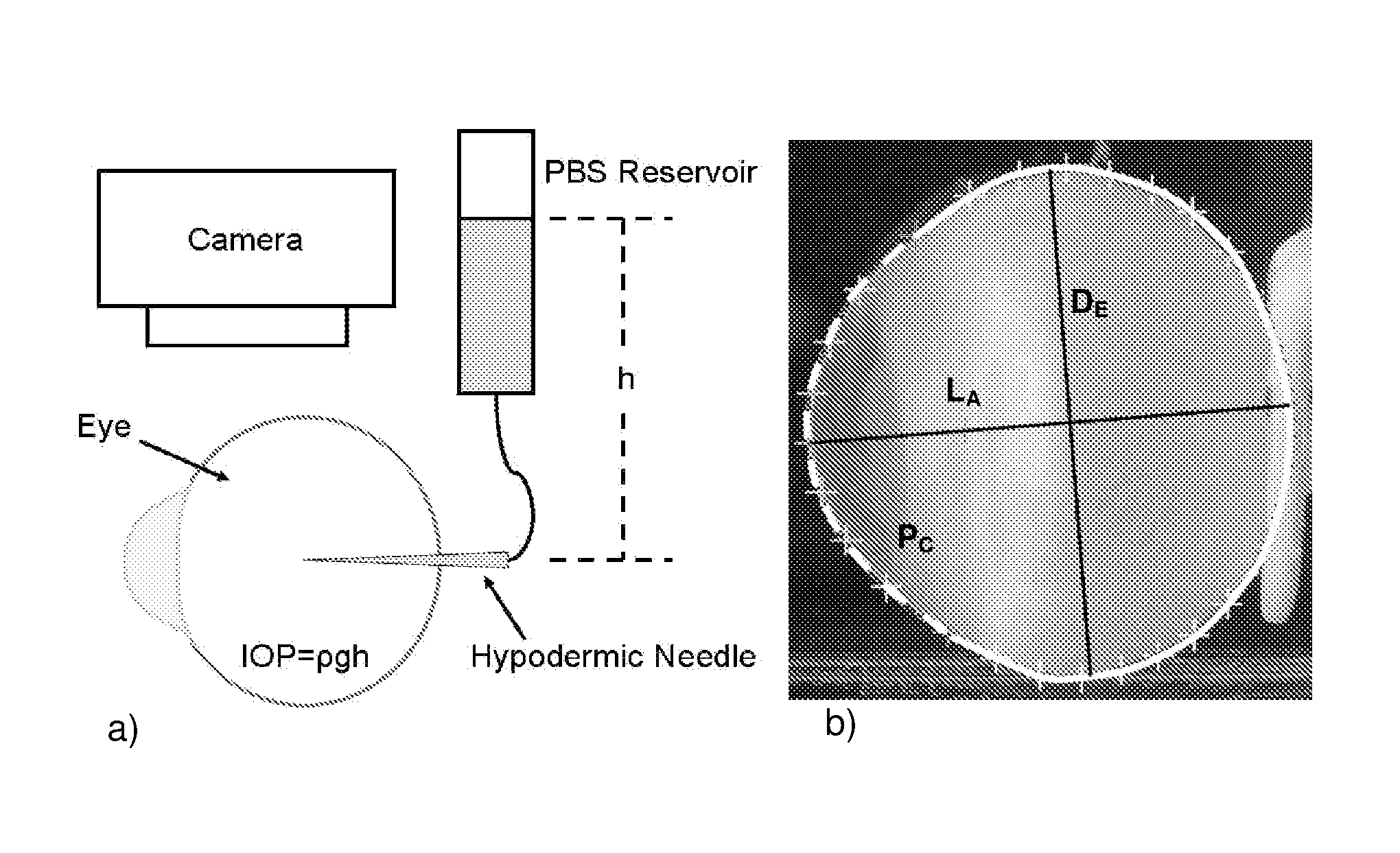 Photochemical therapy to affect mechanical and/or chemical properties of body tissue