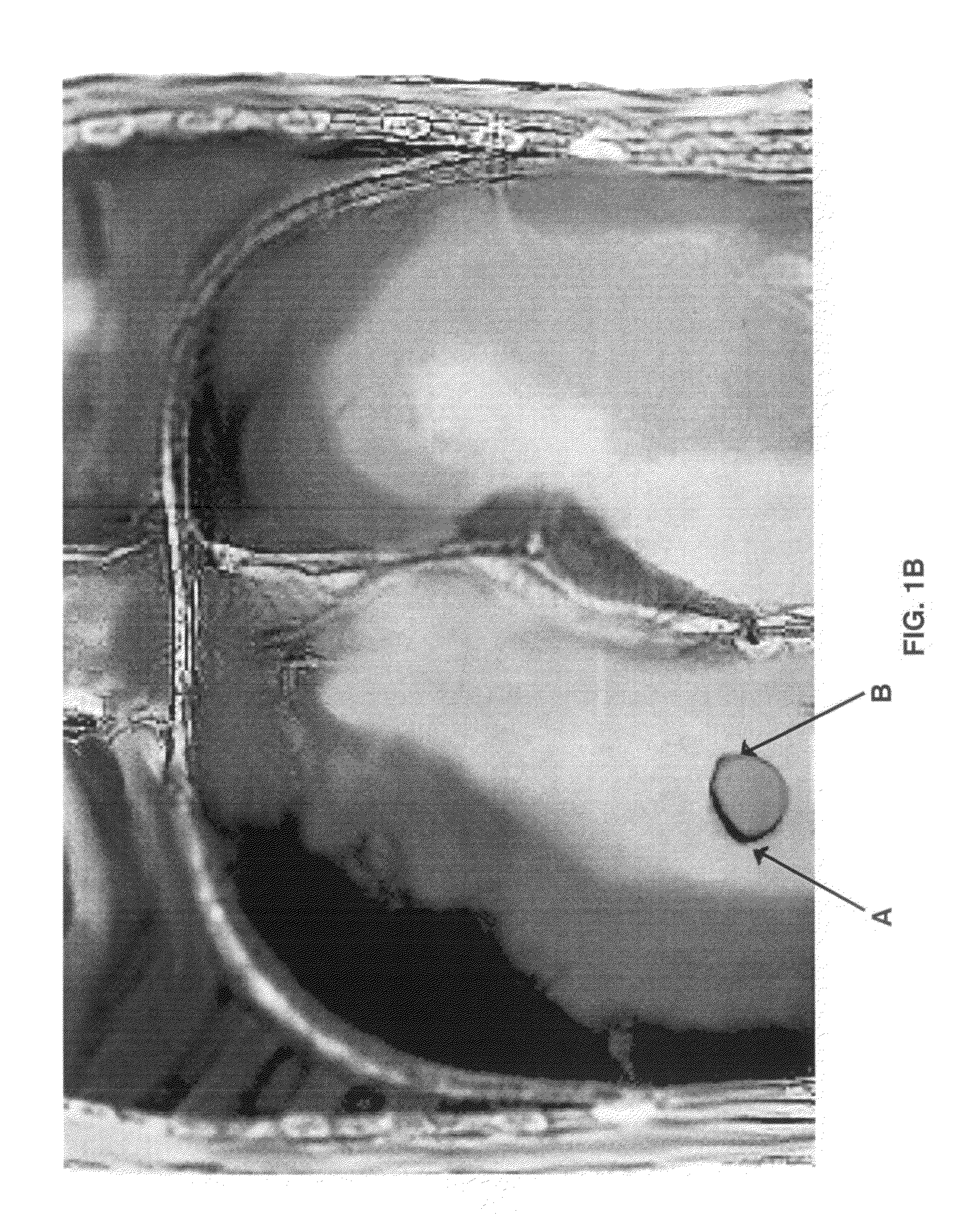 Device and method for measuring anatomic geometries