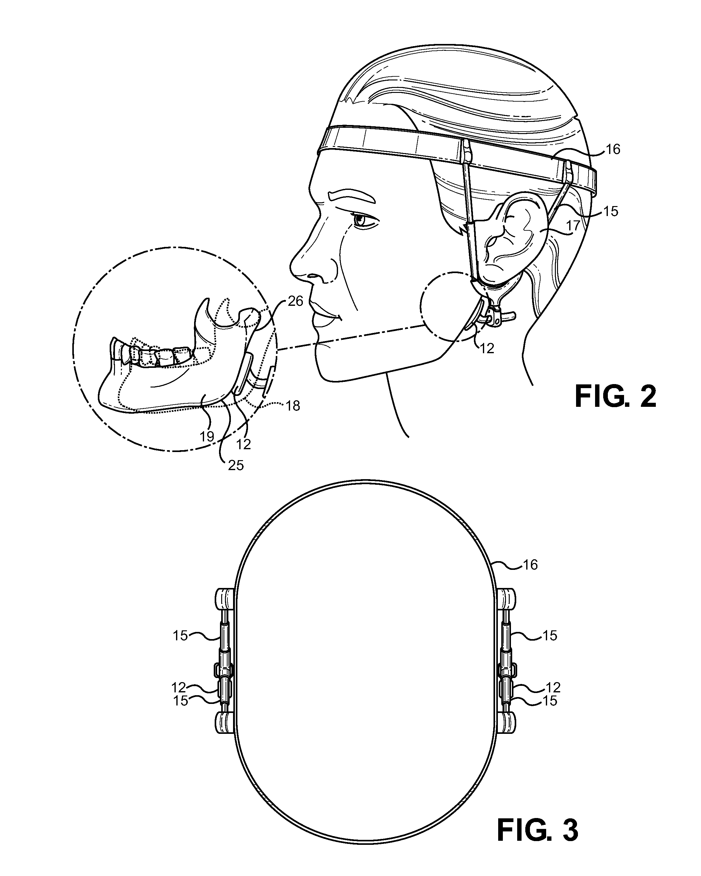 Jaw thrust appliance