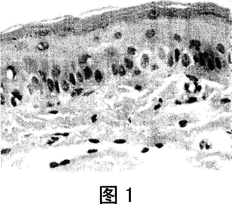 Method of thalidomide for effective interventing oral cancer in animal model