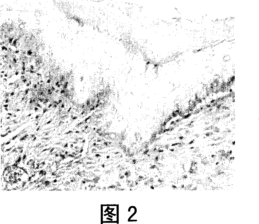 Method of thalidomide for effective interventing oral cancer in animal model