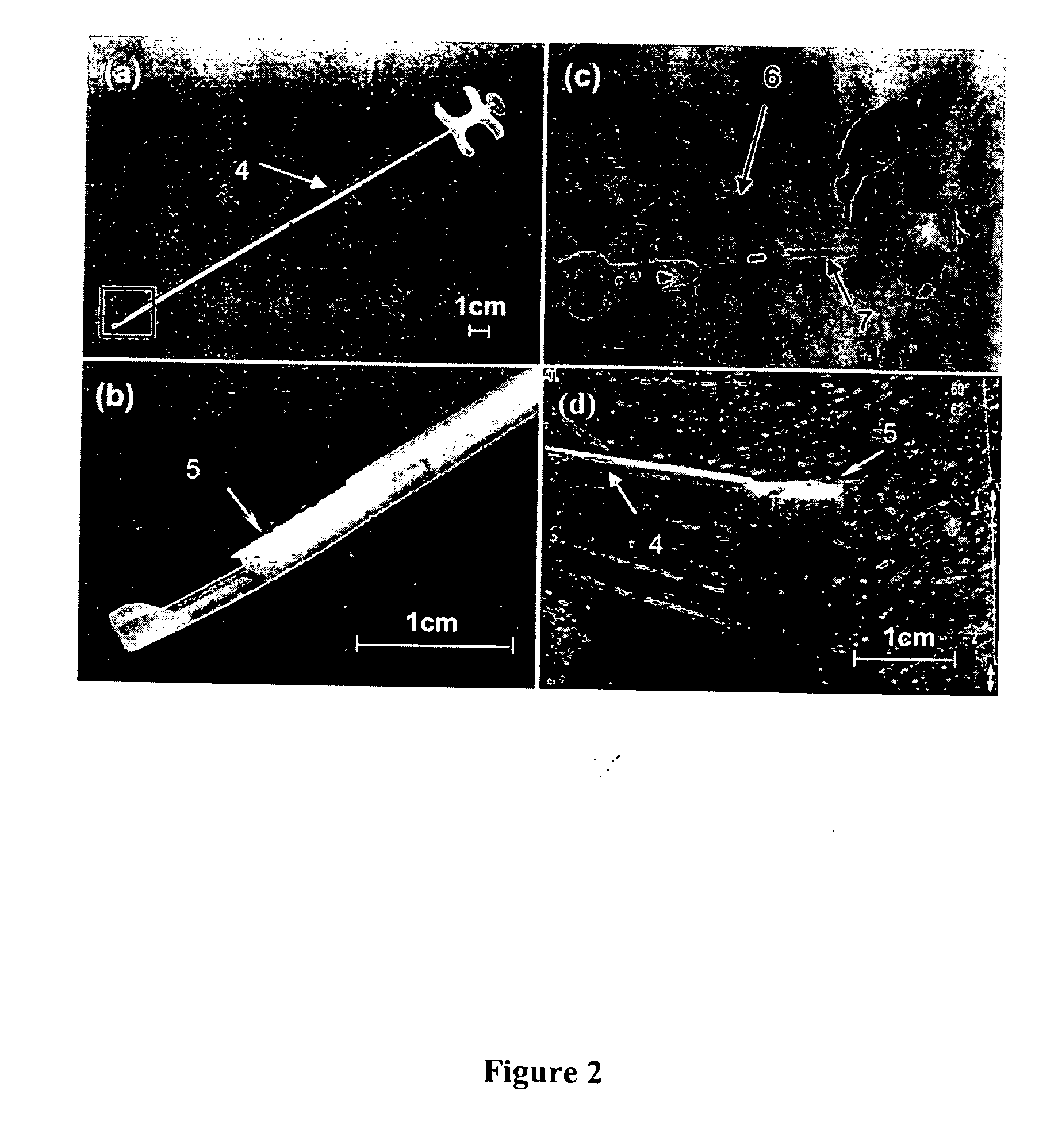 Marker device for X-ray, ultrasound and MR imaging