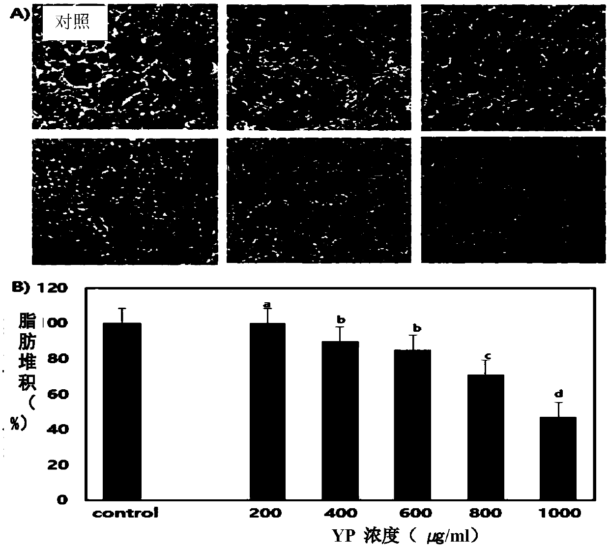 Food ingredient containing fermented orange residue with anti-obesity activity