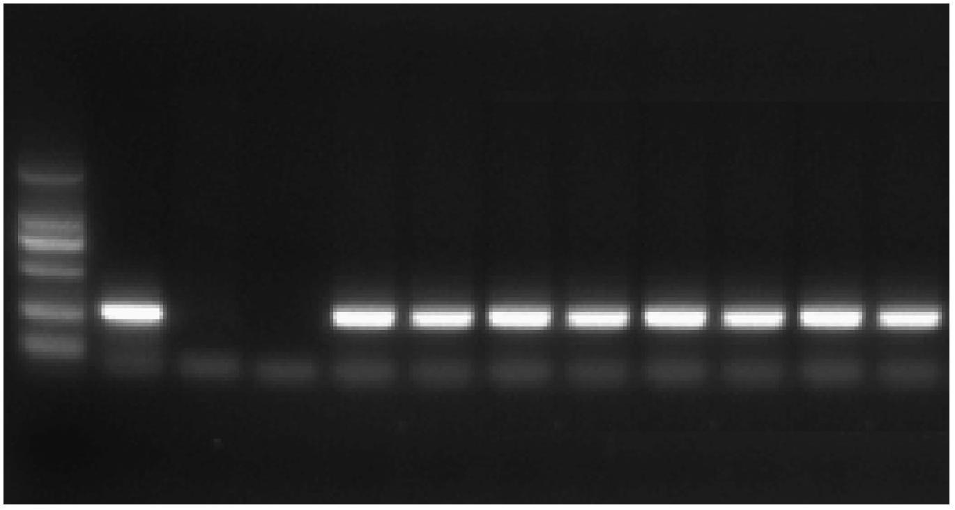 Method and kit for rapidly detecting salmonella living cells in feed by combining ethidium monoazide (EMA) and polymerase chain reaction (PCR)